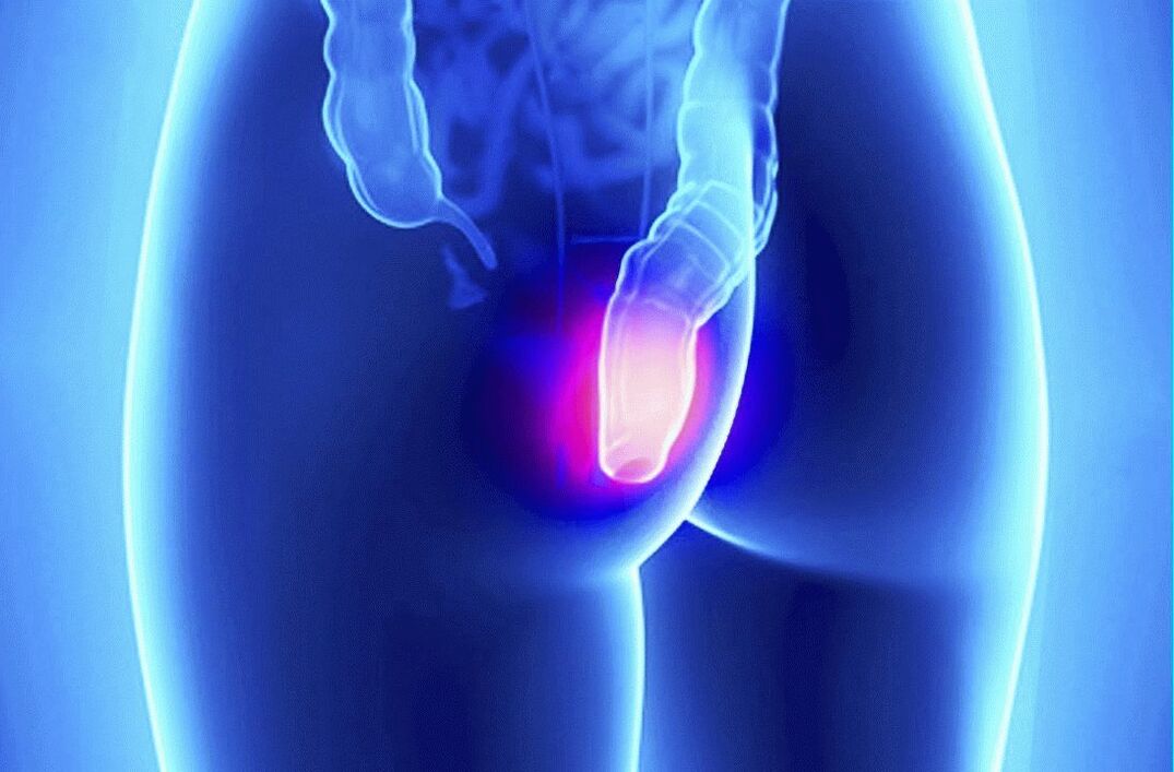 Gelarex може да се използва както външно, така и ректално